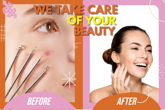 Beauty user generated content example with before and after imagery